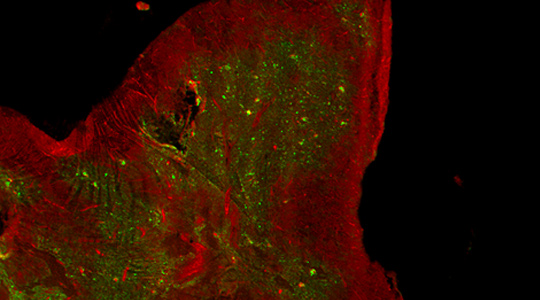 3 of 4, The thymic medulla produces lots of interferon, even in the absence of infection